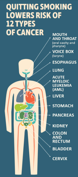 Quitting Smoking Lowers Risk of 12 Types of Cancer